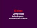 Uterine Fibroids and Pregnancy