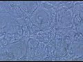 Termite Hindgut Microorganisms