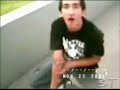 THE WORST SKATEBOARED ACCIDENT\