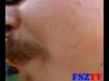 Free Szabolcs Terror Zone