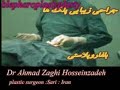 blepharoplasty blepharoplasty