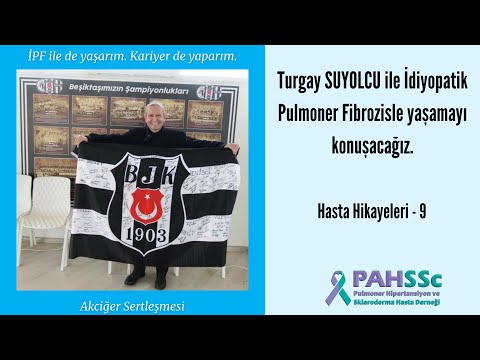 Hasta Hikayeleri - Turgay SUYOLCU - İPF ile Yaşamak - 09 - 2020.05.25