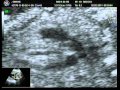 Morfol�gica - 22 semanas e 4 dias / J�lia