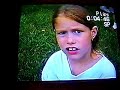 BUG BITES
