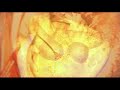 Luomuhappo: Nainen (music video)