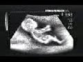 Schumi (baby).3gp Schumi (baby).3gp