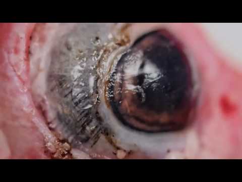 Image de prévisualisation YouTube
