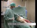 Mises Salgado Operación Pierna Parte 1