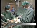 Mises Salgado Operación Pierna Parte 1