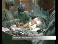 Mises Salgado Operación Pierna Parte 1