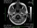 videos de Brain scan MRI