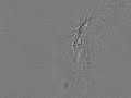 Beating Cilia on a Frog Embryo
