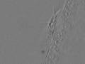 videos de Beating Cilia on a Frog Embryo