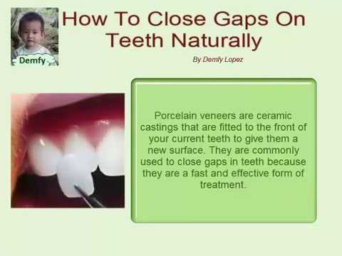 how to fill small gaps in teeth