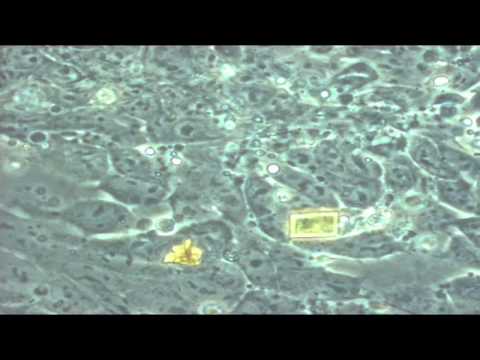 microscopic - Explore an unfamiliar universe in these videos created at the Microscope Imaging Station. This and other explorations from Living Systems on exhibit through ...