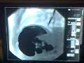 Fluoroscop�a