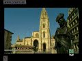Down syndrome:&nbsp;S�ndrome de Down: Discapacidades Humanas 3
