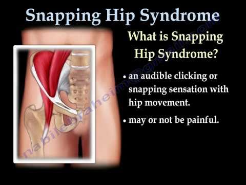 how to treat snapping hip syndrome