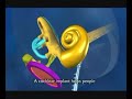  cochlear implant hearing loss deaf