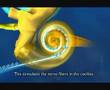Video: L'Impianto Cocleare