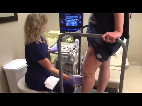 how to assess for dvt