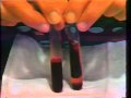 Laboratory Aids In Diagnosis - Part II