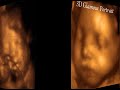 Charlotte Prenatal Ultrasound - My Sunshine Baby Ultrasounds