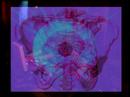 VJING-RECOLLET