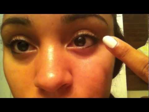 how to cure twitching