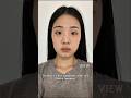 Korean Plastic Surgery Review:  Rhinoplasty, Facial Contouring, Double Eyelid Surgery #nosejobs