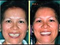 PTG Studios Ft. Restorative & Esthetic Dental Clinic