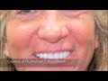 LVI Smile Cosmetic Dentists 3