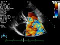Mitral Regurgitation II - Color Doppler Echocardiogram - Dog