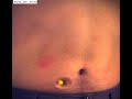 Blow dart hits me, 1000 fps