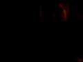 videos de shea trys to burn a hole through a twenty on his arm
