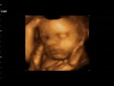 ecografia 4d bebe: samuel andres
