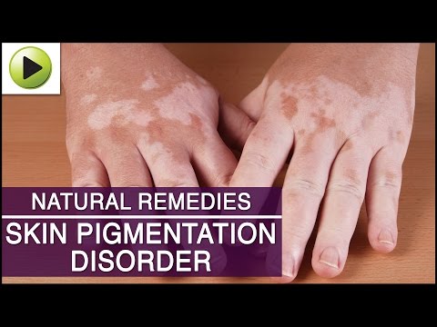 Skin Care - Skin Pigmentation - Natural Ayurvedic Home Remedies