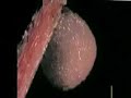 L\