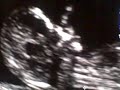 baby-parker-2.html