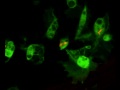 Researchers capture bacterial infection on film