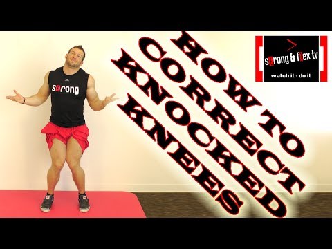 how to fix knock knees