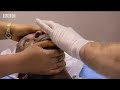 Medical volunteers try to help an old man blinded by cataracts in Africa - BBC