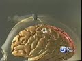 Neural Microelectronics