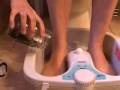 hyperhidrosis doctor, underarm hyperhidrosis cure