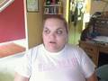 3 Weeks Post-Op***Happy Thanksgiving!***