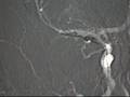 Latest Radiology videos on Radiolopolis