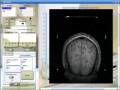 videos de DICOM filter