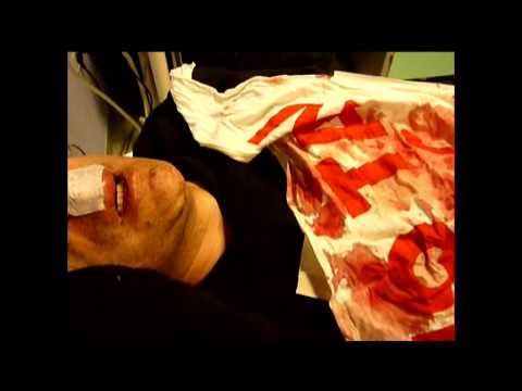 guarda il video