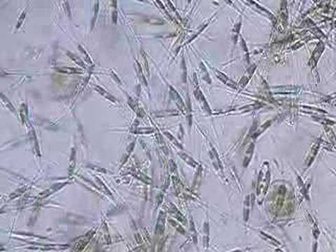 Cylindrotheca diatoms in a salt ...