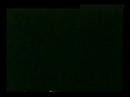 Brian May Live In Beacon Theater 1993 (Part 15 of 16)